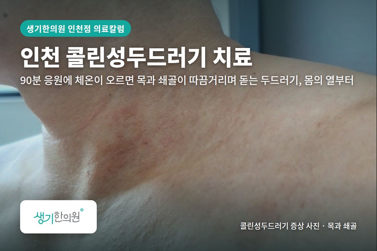 목과 쇄골 콜린성두드러기 증상 사진과 문구 「인천 콜린성두드러기 치료, 90분 응원에 체온이 오르면 목과 쇄골이 따끔거리며 돋는 두드러기, 몸의 열부터 · 생기한의원 인천점」