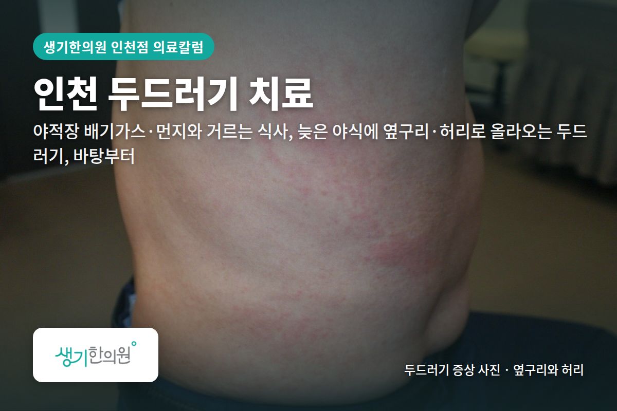 옆구리와 허리 두드러기 증상 사진과 문구 「인천 두드러기 치료, 야적장 배기가스·먼지와 거르는 식사, 늦은 야식에 옆구리·허리로 올라오는 두드러기, 바탕부터 · 생기한의원 인천점」